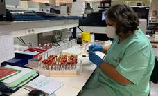 Some 5,400 people live with HIV in Malaga province