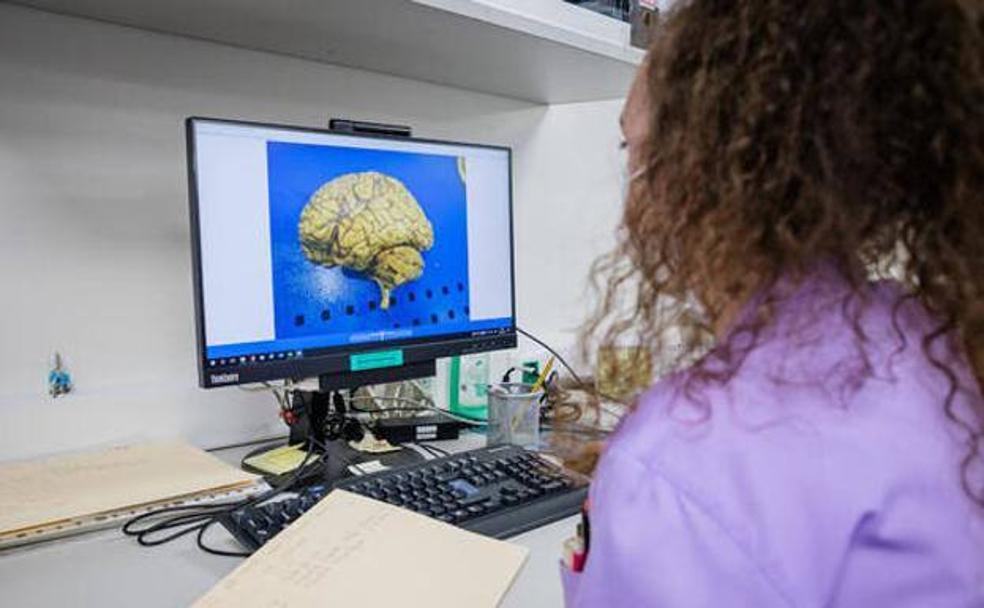 A technician examines a brain scan. 