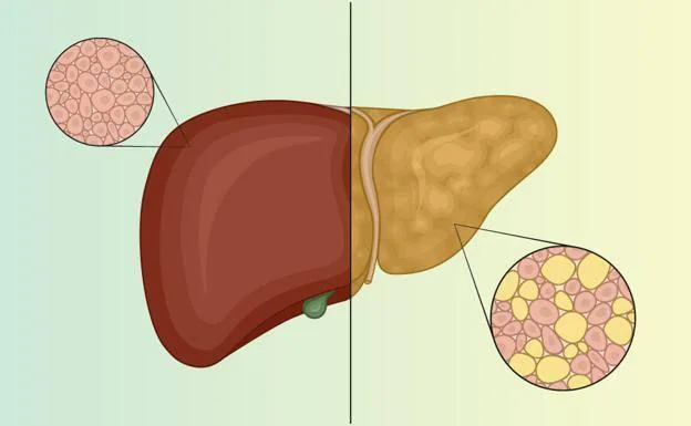 The liver is a powerful purifier that drains and cleans the blood. 
