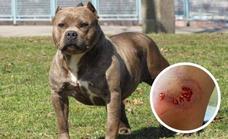 Dangerous breed dog bites vet and employee at Marbella animal shelter