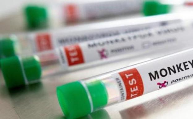 Spain exceeds 5,000 confirmed cases of monkeypox virus