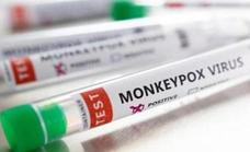 Spain reports 5,792 confirmed cases of monkeypox virus