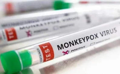 Spain reports 5,792 confirmed cases of monkeypox virus