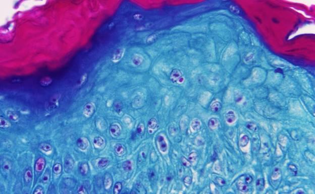The monkeypox virus seen under the microscope. 