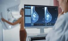 Breast cancer in 2022: treatments are more effective and precise and have fewer side effects