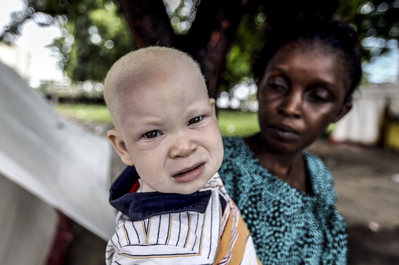 El drama de los albinos de Tanzania