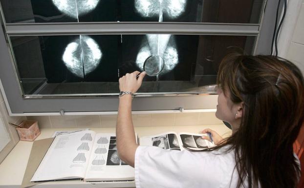 La supervivencia en el cáncer de mama alcanza ya en Málaga al 87% de los casos