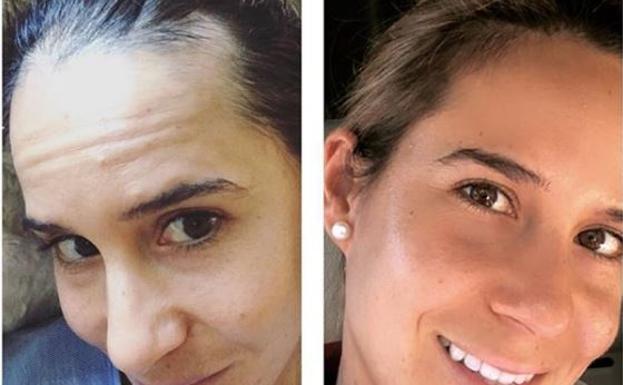 Azahara Muñoz relata su calvario por una enfermedad de tiroides