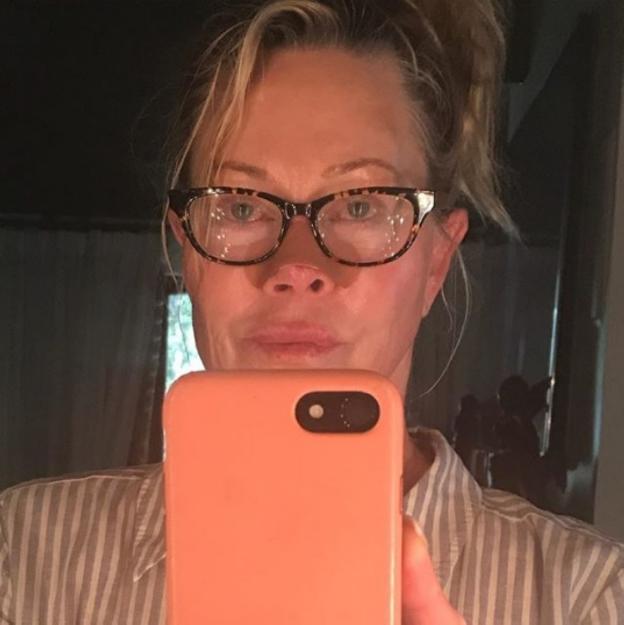 Melanie Griffith se opera un melanoma