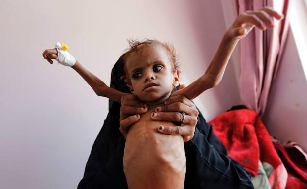 Denuncian que unos 85.000 niños podrían haber muerto de hambre en Yemen desde 2015