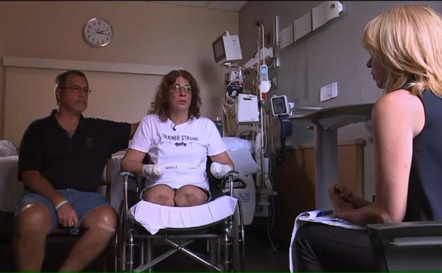 Amputan las manos y las piernas a una mujer tras infectarse por un lametón de su perro