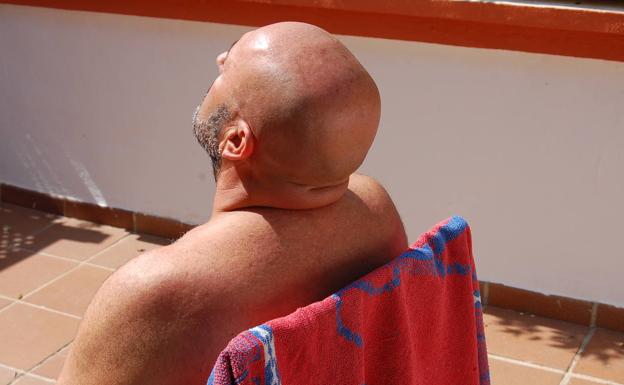 Ni un pelo de protección