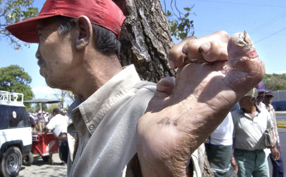 Justicia universal para el asesino de esperma