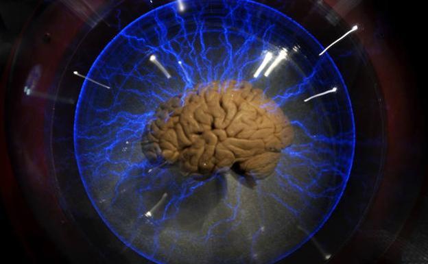 Cuando falta un hemisferio del cerebro la otra mitad compensa las conexiones