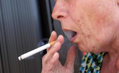 El tabaco es la causa principal que provoca la aparición de un carcinoma de pulmón./SUR