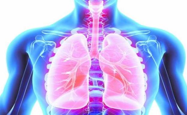 Las anomalías pulmonares que puede generar la Covid-19 meses después del contagio