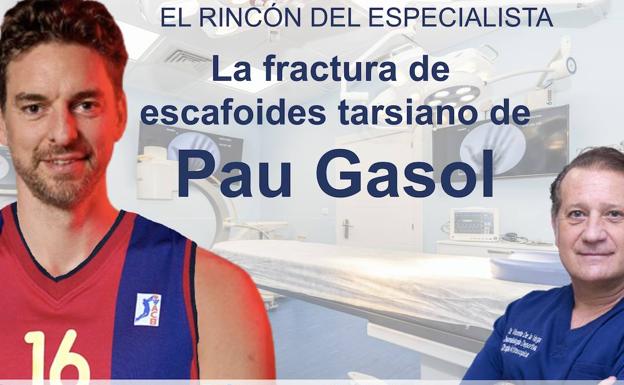 El rincón del especialista: La fractura de escafoides tarsiano de Pau Gasol