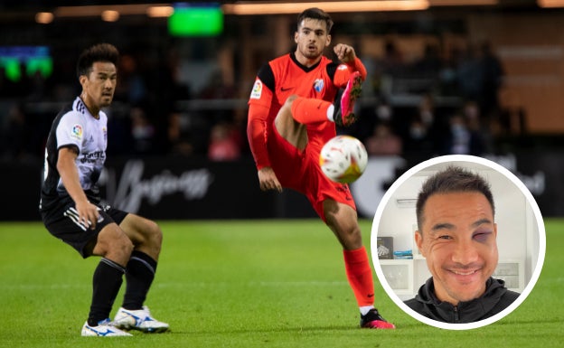 Okazaki se partió la cara frente al Málaga