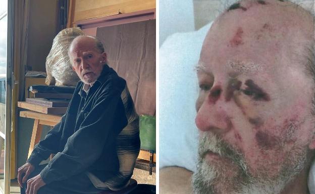 «Mis manos me salvaron la vida, aunque me dejaron los huesos machacados de la paliza»