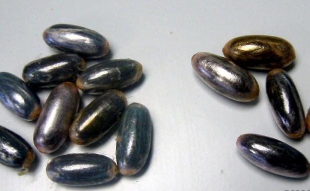 Acude a un hospital de Málaga con un fuerte dolor abdominal y le extraen 17 bellotas de hachís de su estómago