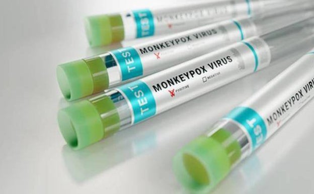 Los casos de viruela del simio ascienden ya a 60 en la provincia de Málaga