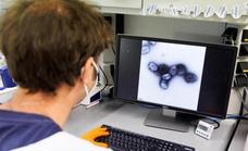 El aviso de un experto de la OMS sobre la viruela del mono: «No tardaremos en declarar la pandemia»