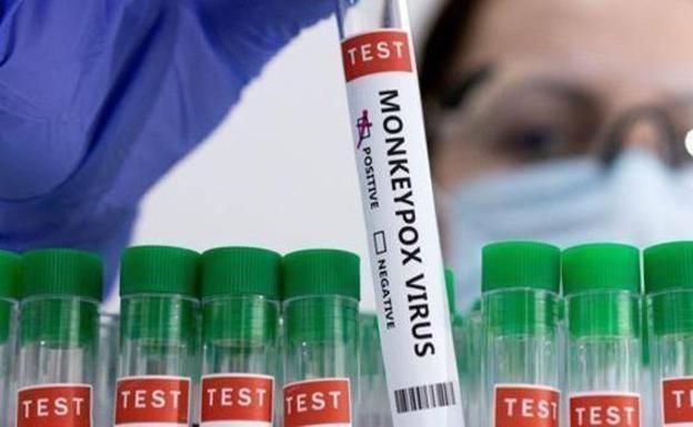 Andalucía sigue bajando los casos de viruela del mono hasta registrar 217 y suma ya 510 vacunados