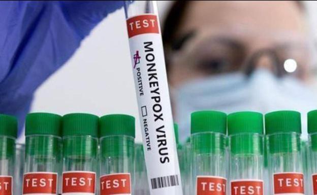 Andalucía registra 58 casos activos de viruela del mono y suma 1.263 personas vacunadas