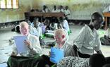 Niños albinos estudian en una escuela de primaria para ciegos de Tanzania, convertida en santuario para quienes sufren falta de pigmentación./AFP