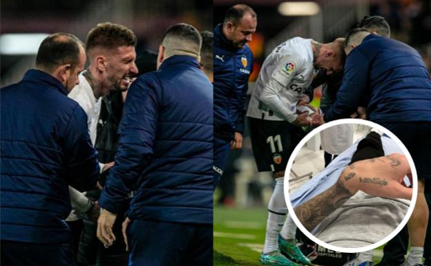 Samu Castillejo sufre una aparatosa fractura