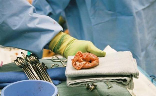 La donación de órganos en Andalucía crece cerca del 25% con 416 donaciones y 908 trasplantes