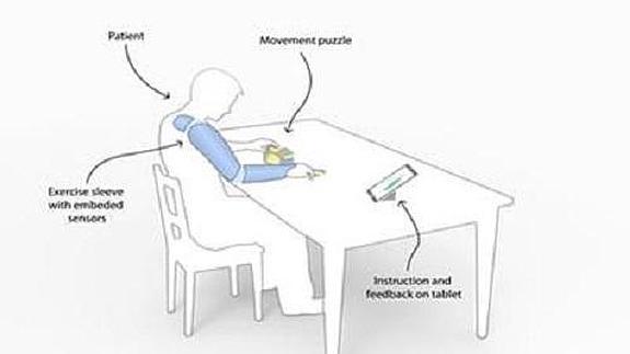 Desarrollan una manga inteligente que recupera la movilidad tras un derrame cerebral