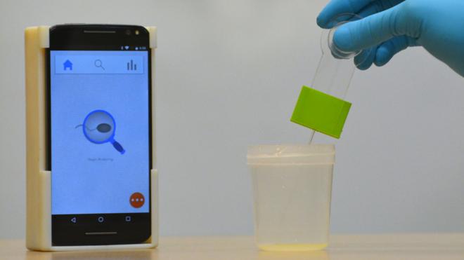Una ‘app’ permite medir la calidad del esperma