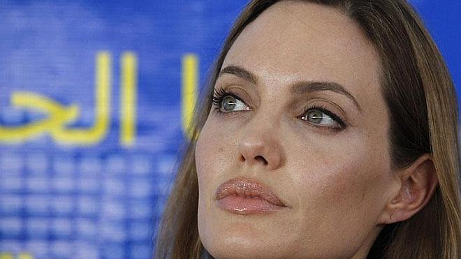 Un láser de 20.000 dólares: El secreto de la eterna juventud de Angelina Jolie