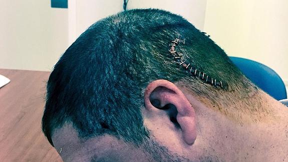 Los detenidos por el apuñalamiento del paseo marítimo, arrestados por una agresión a botellazos