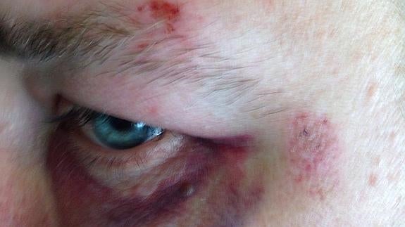 El ciudadano que dijo haber sido agredido por un operario de Limasa retira su denuncia