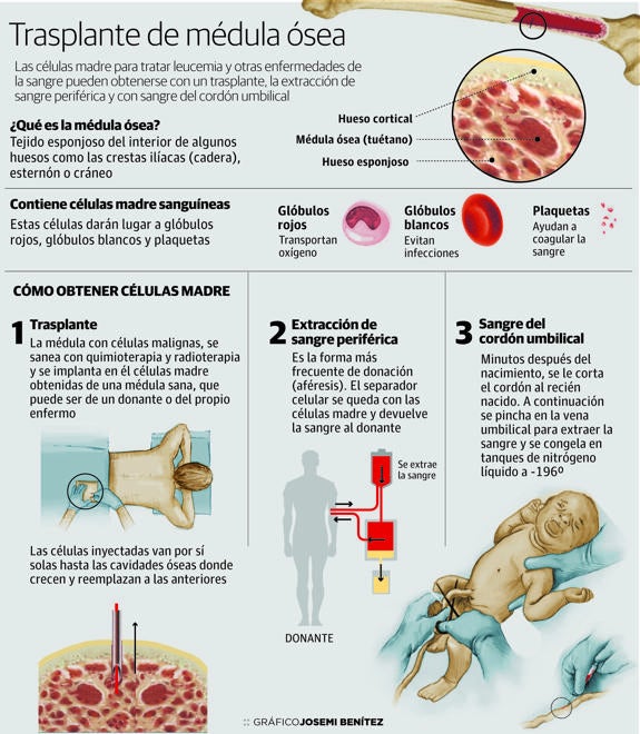 Los pacientes logran un trasplante en el 90% de los casos