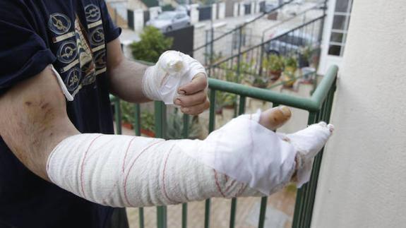 «El perro tenía dos disparos encima y seguía mordiéndome, hasta que le dieron el tercero»